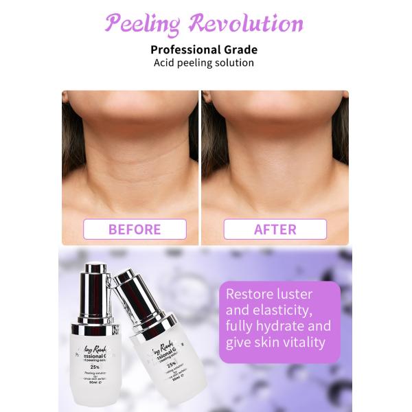 25% Skin Peeling Solution Peeling Revolution Skin Exfoliating Serum