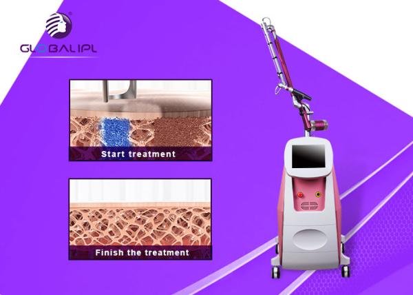1064 / estilo do Portable da máquina da remoção da tatuagem do laser do Nd Yag do interruptor de 532nm Q