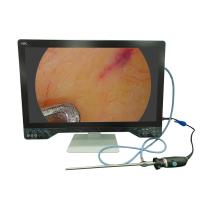 Système de caméra d'endoscopie médicale 4K de 32 pouces avec fonction laparoscopique USB