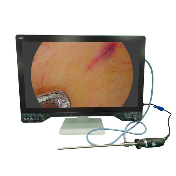 Système de caméra d'endoscopie médicale 4K de 32 pouces avec fonction laparoscopique USB