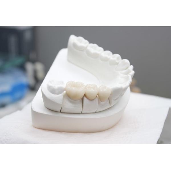 Основной металл мычки зубоврачебный сплавляет съемный протез для системы CAD CAM открытой