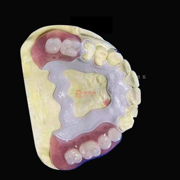 3D Printing Peek Frame Removable Dentures Acrylic Teeth China Dental Lab
