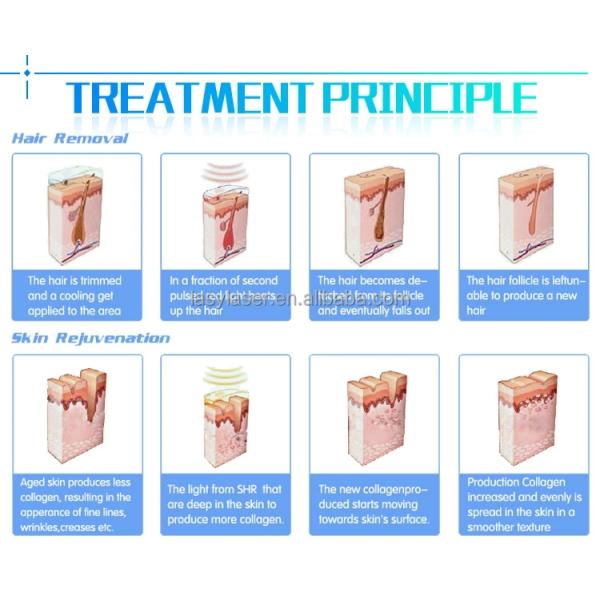 Удаление моли 110v машины удаления волос лазера OPT IPL SHR профессиональное