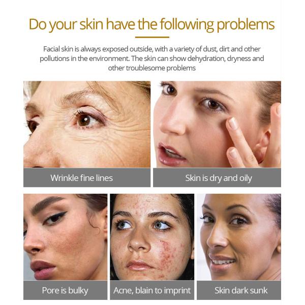 Сливк ремонта Mucin улитки сливк 30g 97,5% корейской ночи дня увлажнителя лицевая