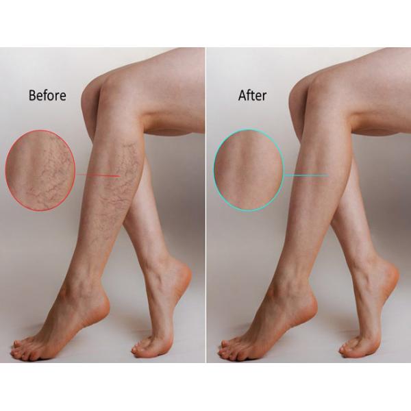 3 в 1 безболезненной машине Pressotherapy массажа ноги ботинок