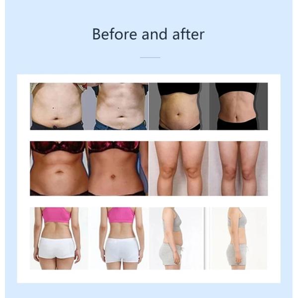 Мини-электрический стимулятор мышц Slim HI EMT для похудения