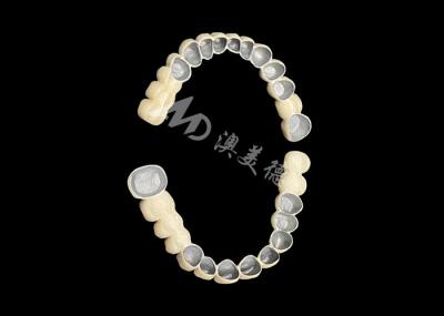 Customized Porcelain Fused To Metal Dental Crown Bridge For Natural Smile Enhancement