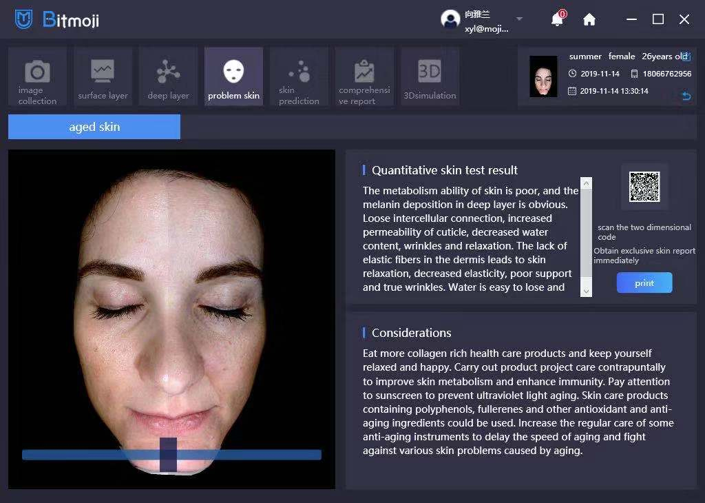 Машина диагноза анализатора Skincare блока развертки стороны Ce 3d