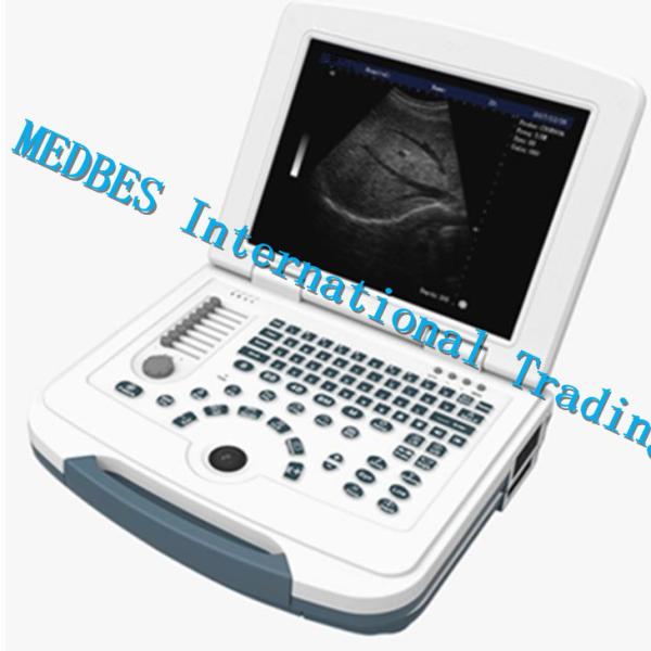 Portable 2D BW Ultrasound Scanner Black and White Ultrasound Scanner Ultrasound Machine