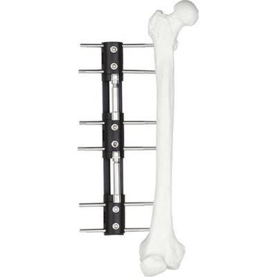 Membro pediatra do orthofix do sistema de LRS que alonga Fixator externo