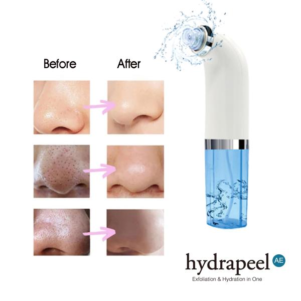 Vacuum Suction Blackhead Remover Pore Cleaner for Face Cleaning and Acne Removal Kit