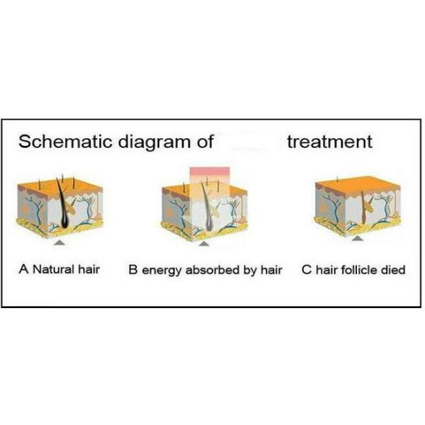 Portable Permanent Laser Hair Removal Machines For Beauty Salon / Home