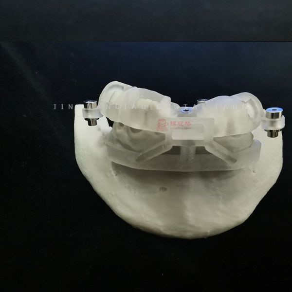 3d Printed Surgical Guides For Dental Implants China Dental Lab