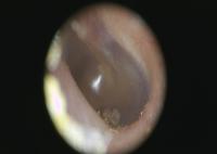 Inspection OTO-RHINO clinique de l'otoscope visuel de Digital de corps humain avec l'otoscope de TFT LCD USB de couleur