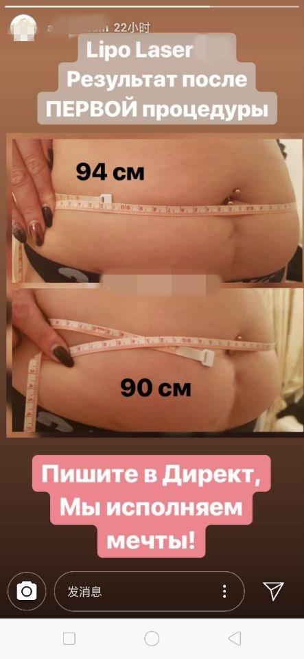 Тело одобренное CE уменьшая не хирургическую машину липосакции