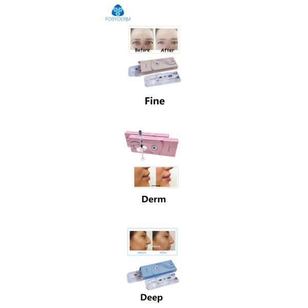 Crosslinked заполнитель HA Hyaluronic кисловочный дермальный с Pre заполненным шприцем