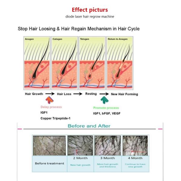650nm Hair Growth Laser Light Device , 90Hz Light Therapy Machine Professional