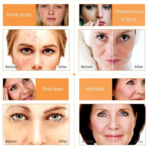 Customized Private Label Vitamin C Serum Anti-Aging Anti-Wrinkle Spot Lightening Morning Evening Moisturizing Whitening Feature
