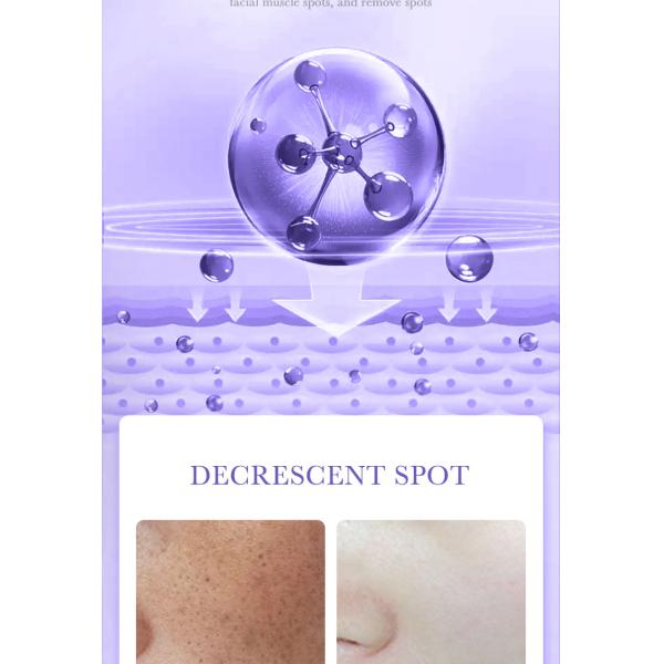 30ml OEM Skin Care Products Freckle Removal Nicotinamide Whitening Spot Removing Facial Mask