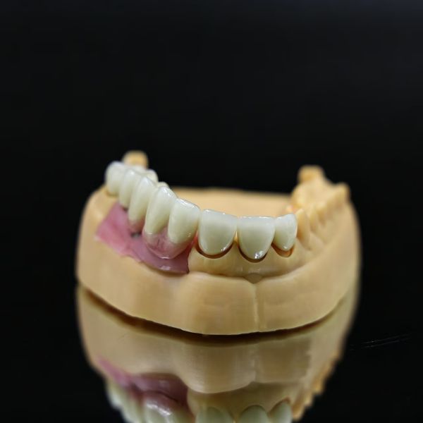 China Outsourcing Dental Lab Porcelain-Fused-to-Metal (PFM) Crowns
