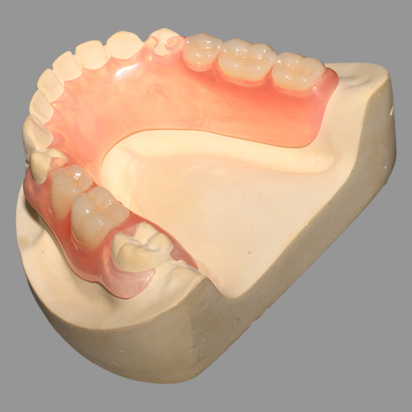 Dental Lab Crown |  Casting Pink TCS Flexible Partials With Excellent Retention