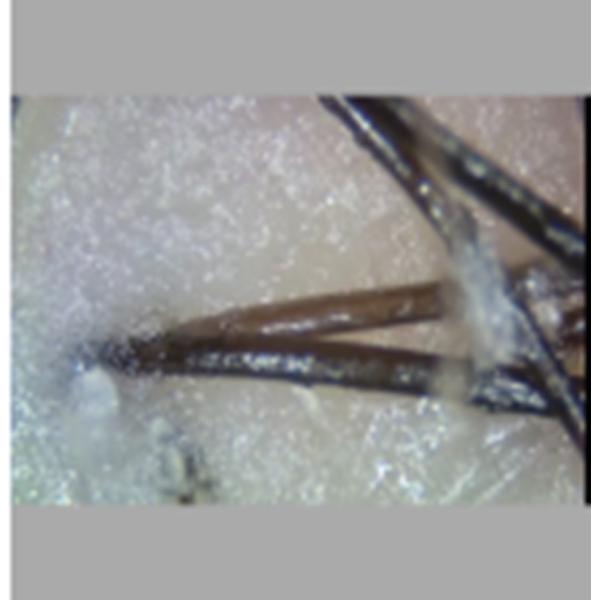 Máquina portátil del escáner del analizador del pelo del analizador de la piel de la belleza