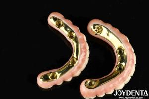 耐久性と生物互換性の高いチバージルコニアハイブリッドブリッジ