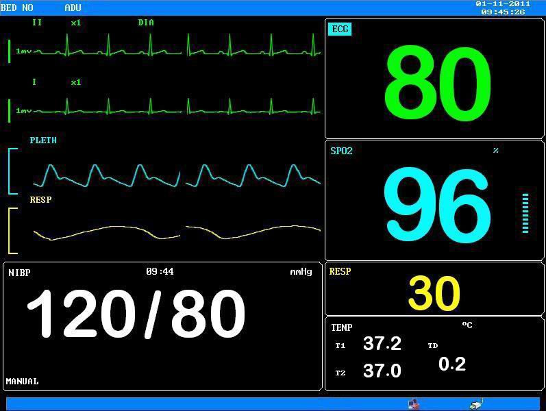 PDJ-3000 портативный многопараметровый пациентский монитор ICU