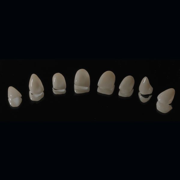 High Translucency Cast Porcelain Emax Veneers China Dental Lab OEM