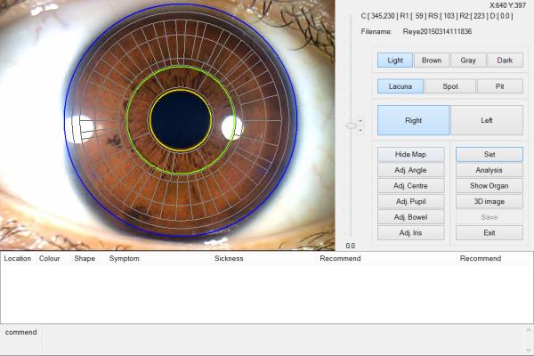 Portable CE Handheld Eye Iris Scanner Analyzer For Health Detect
