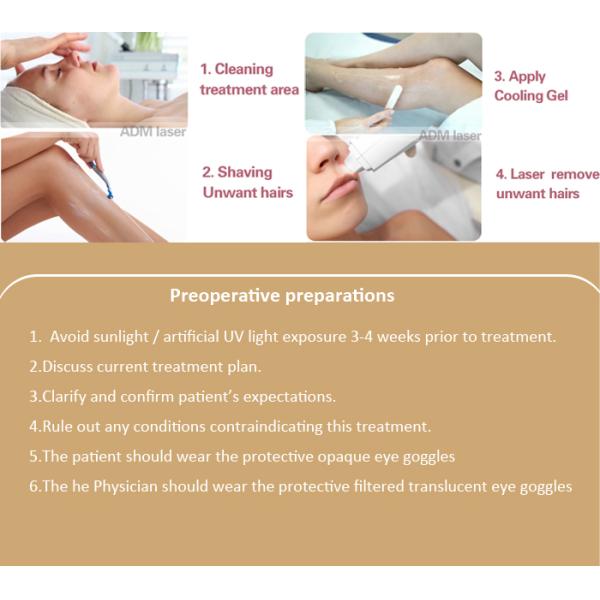 1 - 120J Energy Facial Hair Removal Devices For Hair Removal Treatment