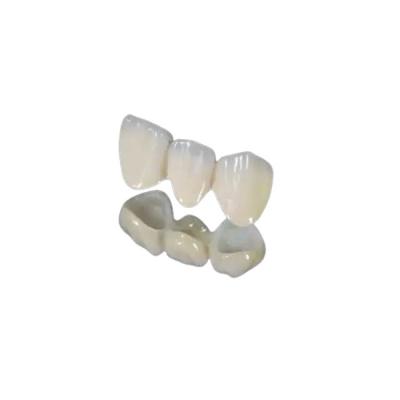 Wear Natural Crown Bridge Teeth Titanium Alloy Single Ended Fixed Bridge Crown