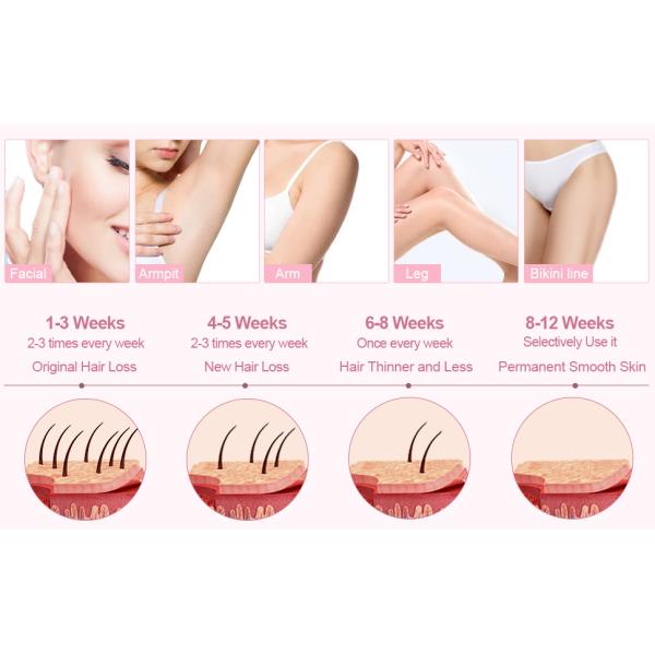 2000W Elight Laser Hair Removal AC110V For Clinic Beauty Spa