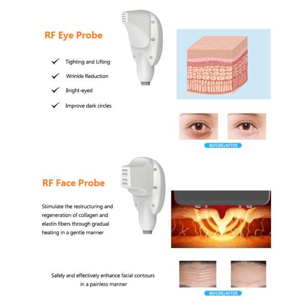 Máquina de microagujas de 300W RF 6 en 1 Máquina multifuncional para el cuidado de la piel