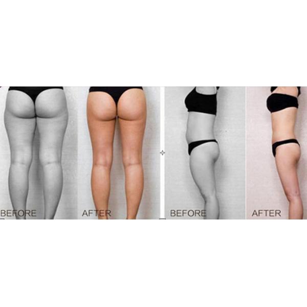 4MHz Hifu Body Slimming Machine , Beauty Salon Equipment High Intensive Ultrasoic