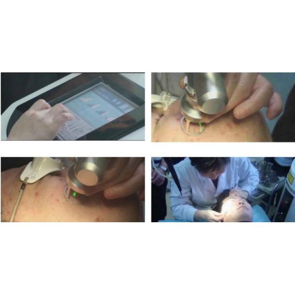 2016 Best 40W RF Tube vertical Co2 Fractional Laser machine