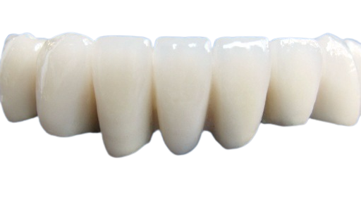 Кроны фарфора красивы в форме Lifelike в цвете и сильной в стабильности