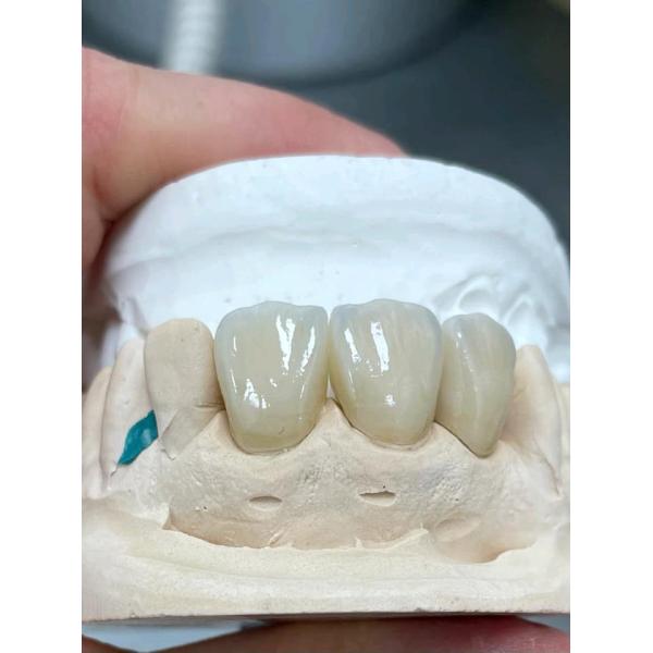 блок Zirconia CAD CAM пробела Zirconia 3D 25mm Pro разнослоистый керамический
