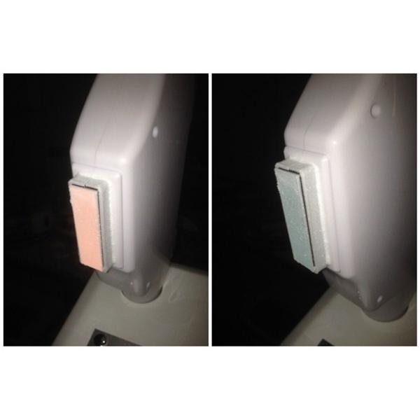 Advanced cooling system of painless IPL laser hair removal machine