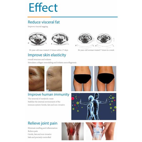 Pain Relief Salon Skin Rejuvenation Laser Machine Portable Alexandrite Nd Yag Laser Hair Removal