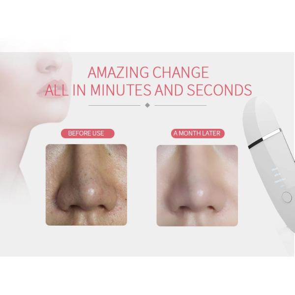 Шабер стороны ультразвуковой поры перевозчика угорь шпателя скруббера кожи более чистый