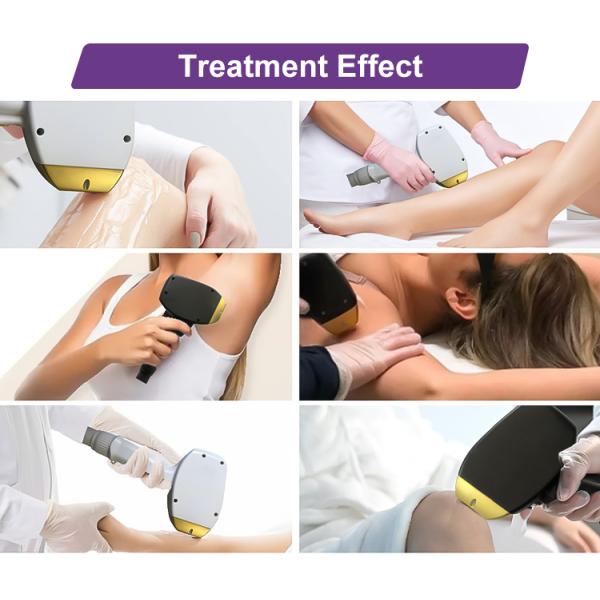 Vertical Professional Painless Lazer 808 nm Titanium Beauty Device Diode Laser Hair Removal Machine