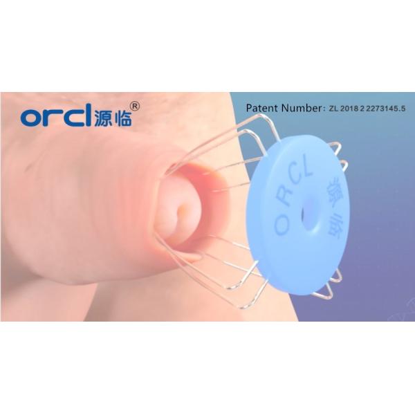 Лечение фимоза из нержавеющей стали Ретрактор для перхоти 2 года