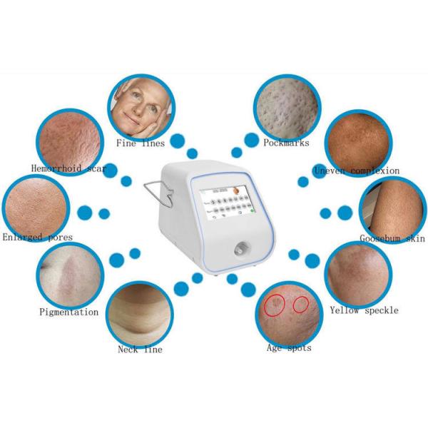 Утверждение ISO CE удаления пигмента машины RF Microneedling 50000 съемок