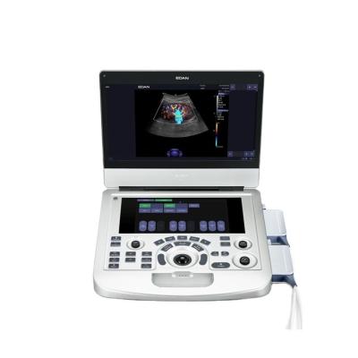 Color Ultrasound Machine Obstetrics And Gynecology Equipment 17MHz Linear Probe
