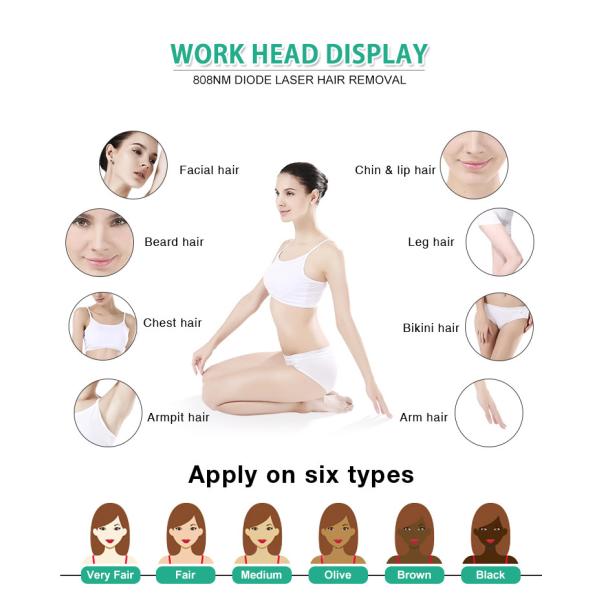 Вертикальная машина удаления волос лазера диода 808nm для губы Chin ноги руки