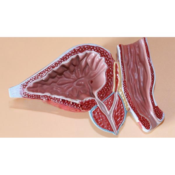Human Anatomy PVC Simulation Human Pathology Prostate Model For Medical Educational