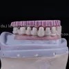 Dental Lab Durability Implants Make Cost-Effective Option in The Long Run