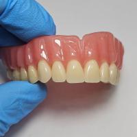 Dentsply Lucitone 199 Dentadura acrílica para uma aparência natural
