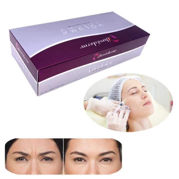 Injection Ha Filler Juvederm 2x1ml Lip Enhancement Remove Wrinkles